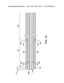 FLEXIBLE CATHETER SHAFT AND METHOD OF MANUFACTURE diagram and image