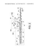 METHOD AND APPARATUS FOR SPARING PAIN CONDUCTING NERVES DURING RENAL     DENERVATION diagram and image