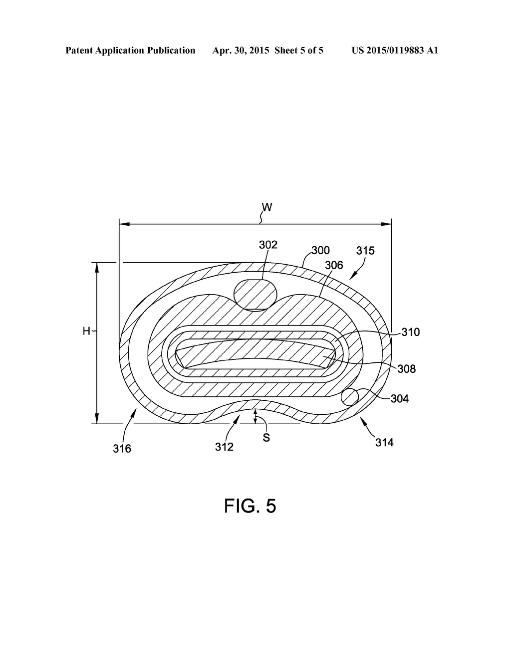 HIGH STRENGTH ELECTRODE ASSEMBLY FOR CATHETER SYSTEM INCLUDING NOVEL     ELECTRODE - diagram, schematic, and image 06