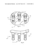 GLENOID ARTHROPLASTY AND OFFSET REAMERS diagram and image