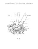 GLENOID ARTHROPLASTY AND OFFSET REAMERS diagram and image