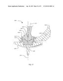 GLENOID ARTHROPLASTY AND OFFSET REAMERS diagram and image