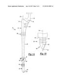 Method And Apparatus For Preparing An Implantation Site diagram and image