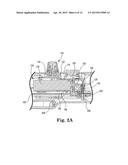 ROTATIONAL ATHERECTOMY DEVICE WITH EXCHANGEABLE DRIVE SHAFT AND MESHING     GEARS diagram and image