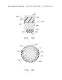 ULTRASONIC SURGICAL INSTRUMENTS diagram and image