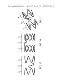 System and Method for Vessel Access Closure diagram and image