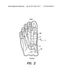 SURGICAL IMPLANT FOR CORRECTION OF HALLUX VALGUS OR TAILOR S BUNION diagram and image