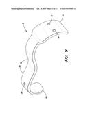 SURGICAL IMPLANT FOR CORRECTION OF HALLUX VALGUS OR TAILOR S BUNION diagram and image