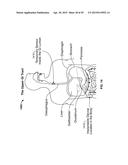 Systems and Methods for Electrical Stimulation of Biological Systems diagram and image