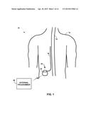 MEDICAL LEAD FASTENER INCLUDING INTEGRATED CLAMP diagram and image