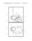 METHOD AND SYSTEM FOR CHARACTERIZING STIMULUS SITES AND PROVIDING IMPLANT     GUIDANCE diagram and image