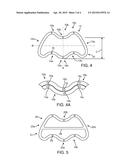 EXTRAVASCULAR DEVICE FOR LIMITING BLOOD FLOW ADJACENT AN ARTERIOVENOUS     FISTULA diagram and image