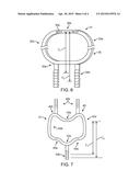 EXTRAVASCULAR DEVICE FOR LIMITING BLOOD FLOW ADJACENT AN ARTERIOVENOUS     FISTULA diagram and image