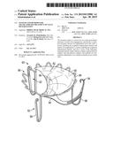 SYSTEMS AND METHODS FOR TRANSCATHETER TREATMENT OF VALVE REGURGITATION diagram and image