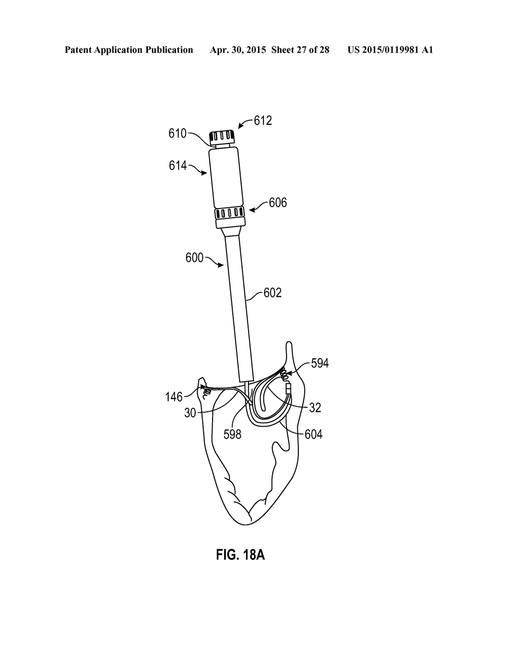 SYSTEMS AND METHODS FOR TRANSCATHETER TREATMENT OF VALVE REGURGITATION - diagram, schematic, and image 28