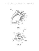 HEART VALVE PROSTHESIS diagram and image