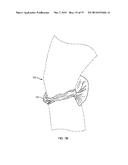 KNEE SUPPORT diagram and image