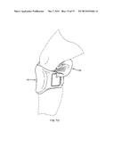 KNEE SUPPORT diagram and image