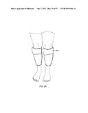 KNEE SUPPORT diagram and image