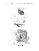 Medical Device for Preparing Thermoplastic Material diagram and image