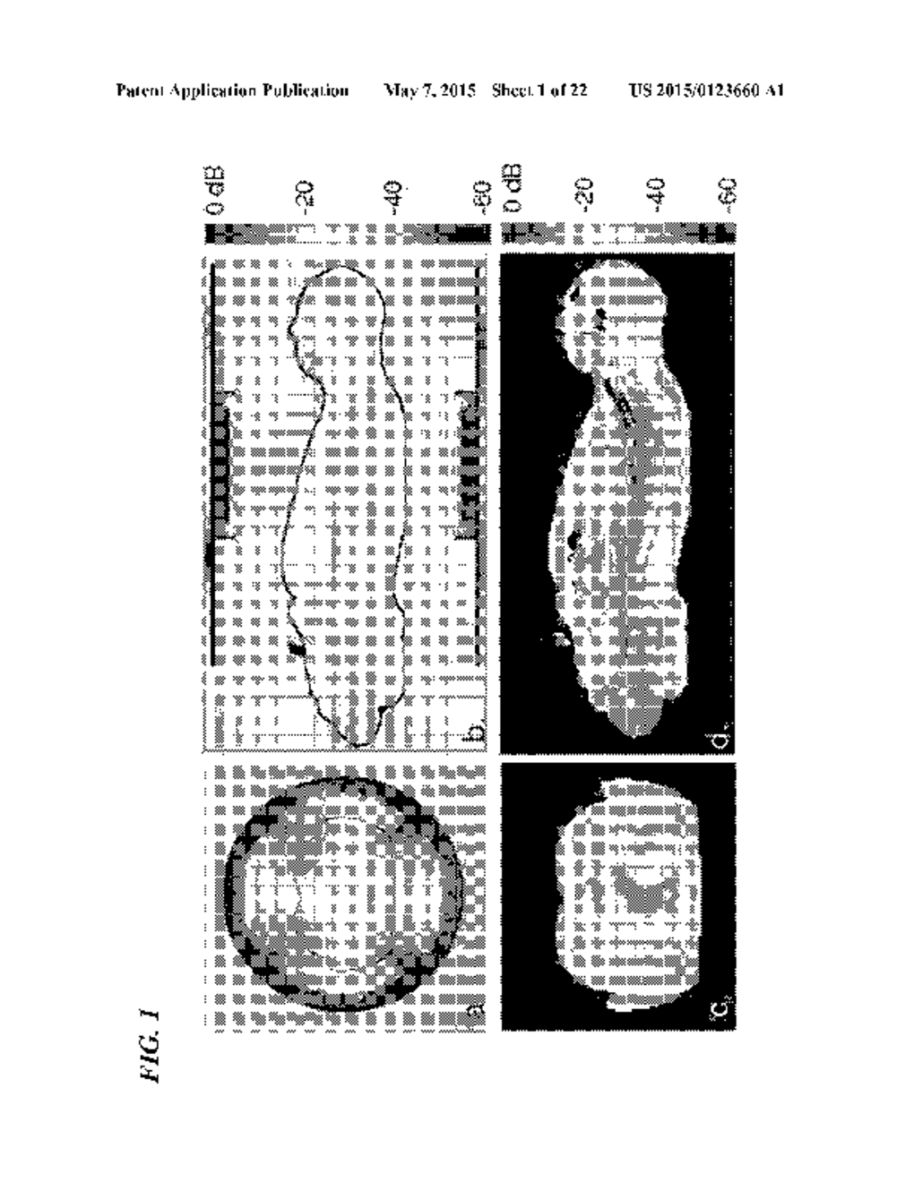 AUTO-TUNE-AND-MATCH COILS FOR HUMAN WHOLE-BODY IMAGING AND METHOD - diagram, schematic, and image 02