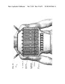 AUTO-TUNE-AND-MATCH COILS FOR HUMAN WHOLE-BODY IMAGING AND METHOD diagram and image