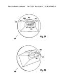 MOTOR VEHICLE HEADLIGHT HAVING A COMPLEX HEADLIGHT LENS diagram and image