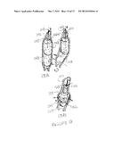 METHODS AND APPARATUS FOR TRANSESOPHAGEAL MICROACCESS SURGERY diagram and image