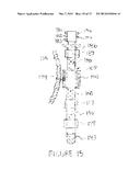 METHODS AND APPARATUS FOR TRANSESOPHAGEAL MICROACCESS SURGERY diagram and image