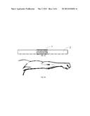 BLOOD SAMPLING diagram and image