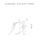 RETROGRADE ENTRY ANTEGRADE PLACEMENT FOR FEMORAL ARTERY ACCESS diagram and image