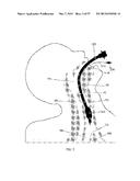 DEVICES AND METHODS FOR AIRWAY MEASUREMENT diagram and image