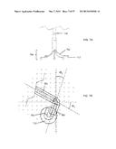 DEVICES AND METHODS FOR AIRWAY MEASUREMENT diagram and image