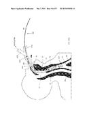 DEVICES AND METHODS FOR AIRWAY MEASUREMENT diagram and image