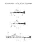 DEVICES AND METHODS FOR AIRWAY MEASUREMENT diagram and image