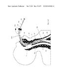 DEVICES AND METHODS FOR AIRWAY MEASUREMENT diagram and image