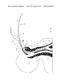 DEVICES AND METHODS FOR AIRWAY MEASUREMENT diagram and image