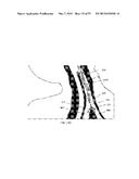 DEVICES AND METHODS FOR AIRWAY MEASUREMENT diagram and image