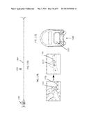 DEVICES AND METHODS FOR AIRWAY MEASUREMENT diagram and image