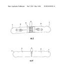 UNIVERSAL SPINE BRACE WITH CABLE TENSIONING SYSTEM diagram and image