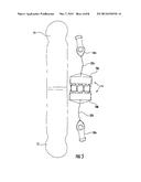 UNIVERSAL SPINE BRACE WITH CABLE TENSIONING SYSTEM diagram and image