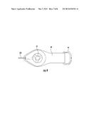 UNIVERSAL SPINE BRACE WITH CABLE TENSIONING SYSTEM diagram and image