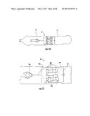 UNIVERSAL SPINE BRACE WITH CABLE TENSIONING SYSTEM diagram and image