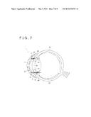 MEDICAL TREATMENT DEVICE diagram and image