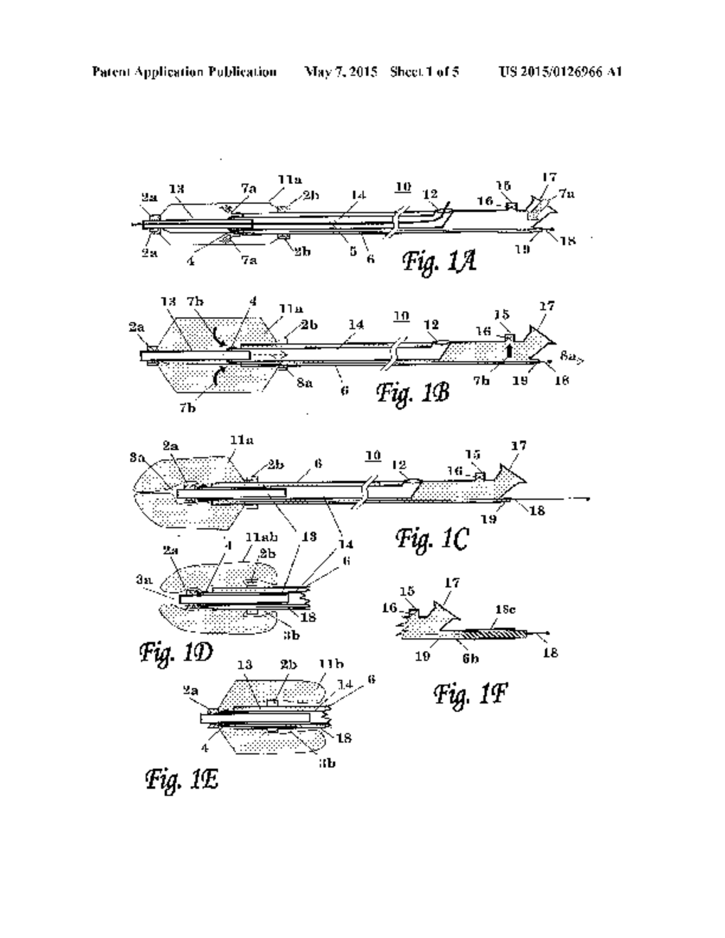 BALLOON CATHETER - diagram, schematic, and image 02