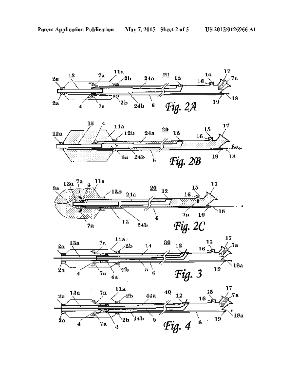 BALLOON CATHETER - diagram, schematic, and image 03