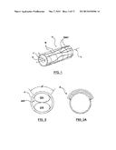 Apparatus and Methods Related to Constrained Deployment of Cryogenic     Balloons for Limited Cryogenic Abiation of Vessel Walls diagram and image