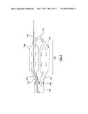 Apparatus and Methods Related to Constrained Deployment of Cryogenic     Balloons for Limited Cryogenic Abiation of Vessel Walls diagram and image