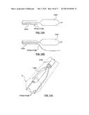 Apparatus and Methods Related to Constrained Deployment of Cryogenic     Balloons for Limited Cryogenic Abiation of Vessel Walls diagram and image