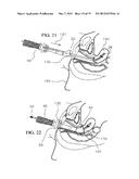 ERGONOMIC, LIGHTED UTERINE MANIPULATOR WITH CAUTERY diagram and image